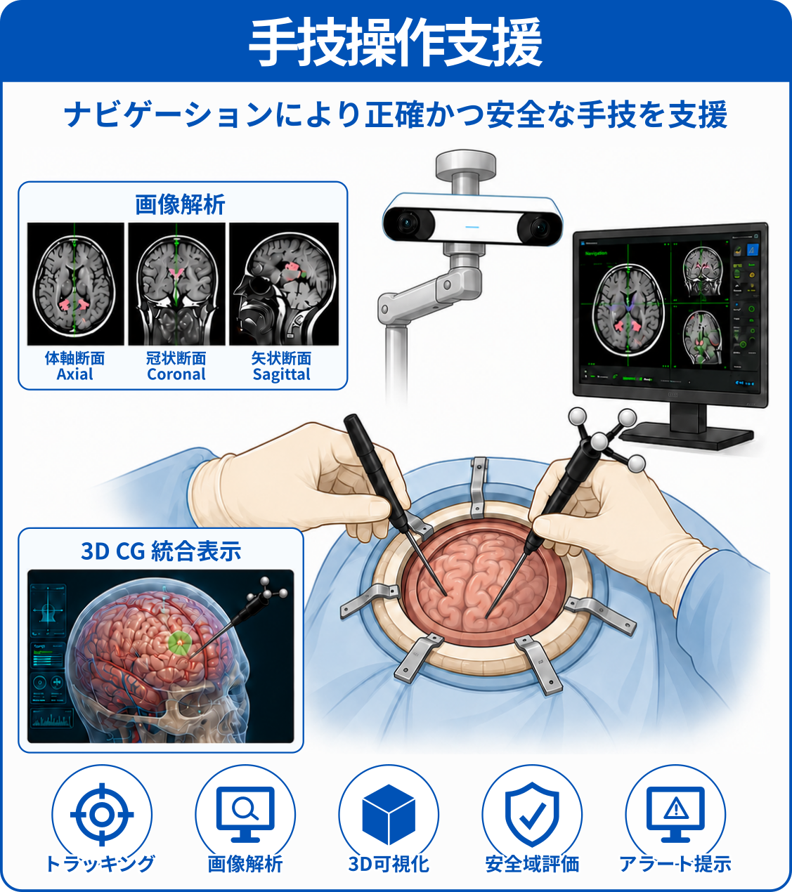 手技操作支援