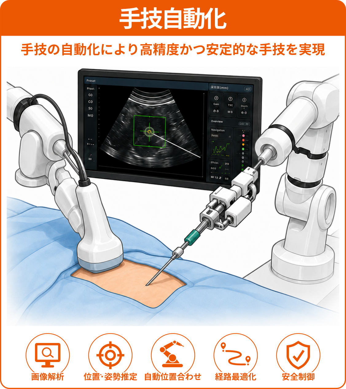 手技自動化
